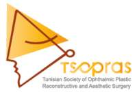 TSOPRAS Logo