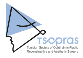 TSOPRAS Logo